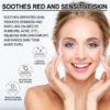 Facial Treatment Essence, Lighten Facial Acne Mark Oil Control Firming Skin Essence – Image 5