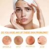 Facial Treatment Essence, Lighten Facial Acne Mark Oil Control Firming Skin Essence – Image 4